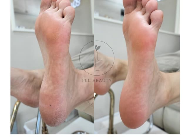 여패디