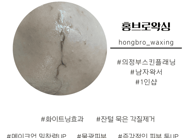 남자스킨플래닝+수염