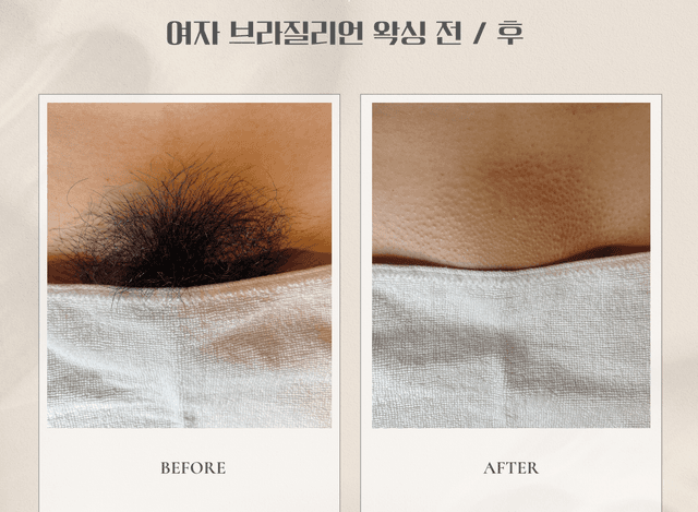 여자 브라질리언 고급(올누드)