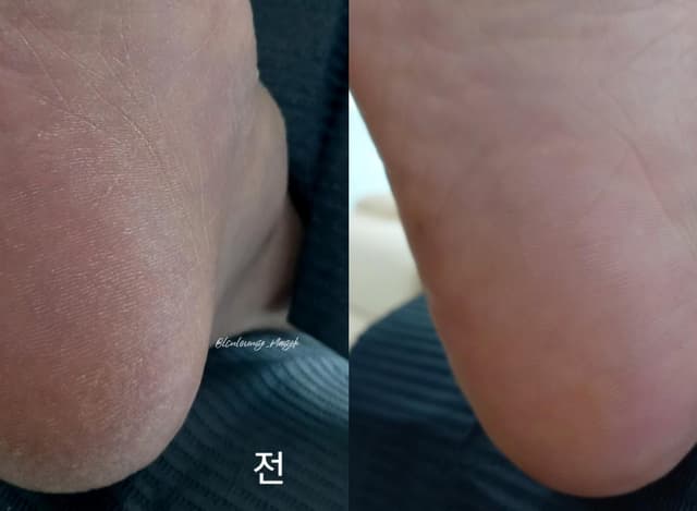 패디) T스파 B코스