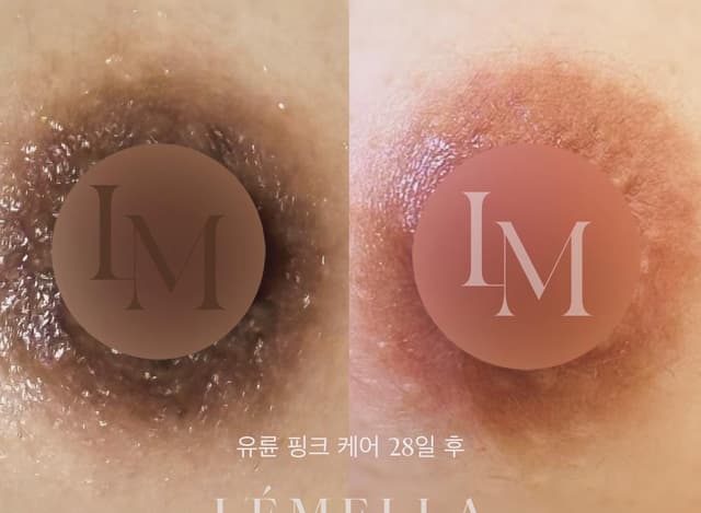 유륜