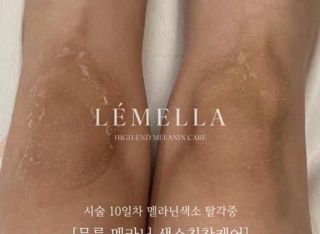팔꿈치/무릎/복숭아뼈/항문