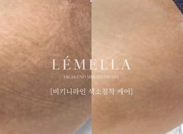 Y존