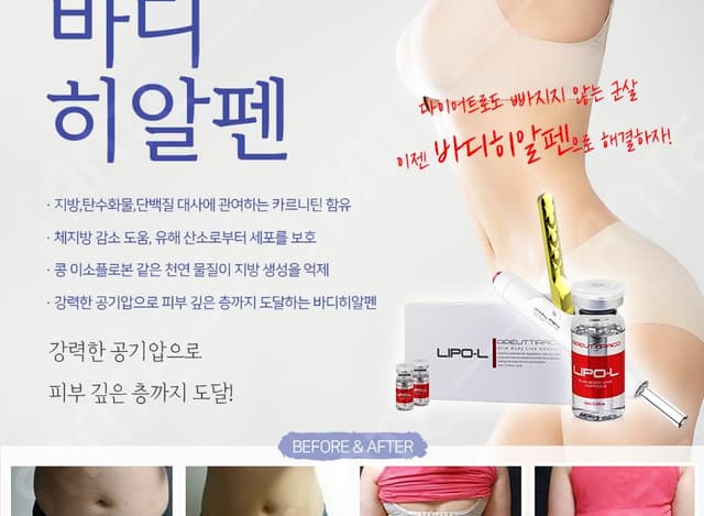 바디디자인