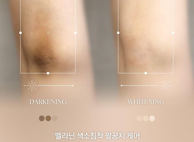 팔꿈치