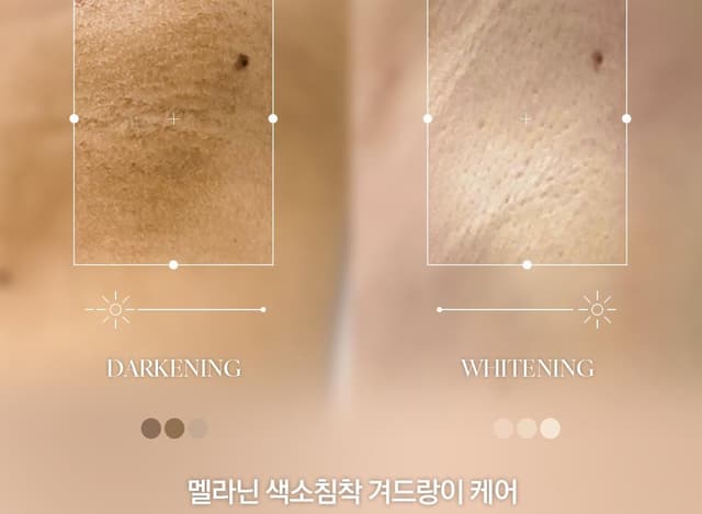 겨드랑이