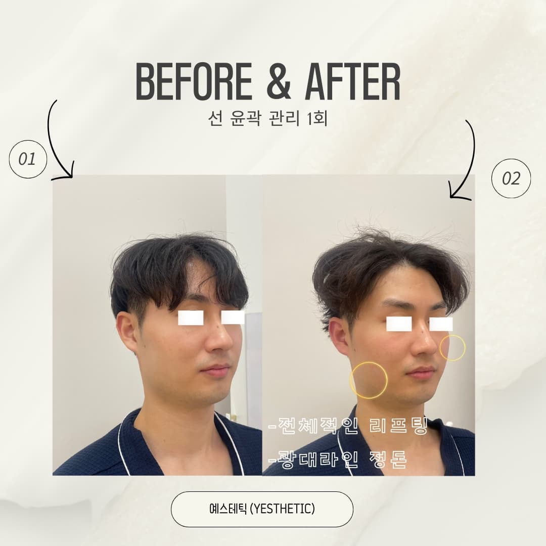 선 윤곽 관리