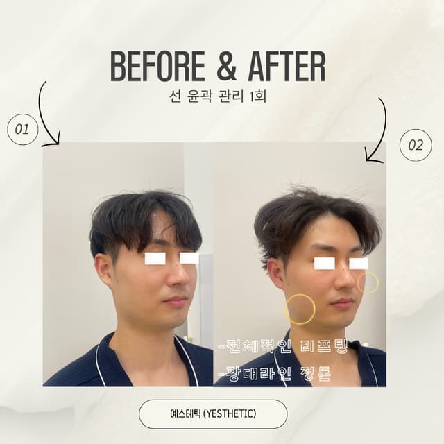 선 윤곽 관리