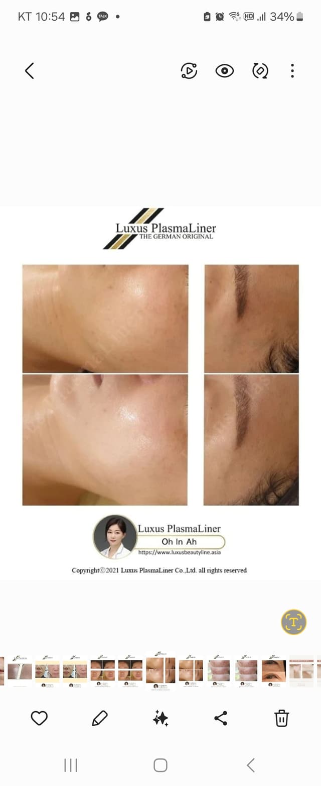 독일 룩서스 플라즈마케어