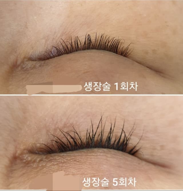 속눈썹 생장술3회권(피부보습2회)