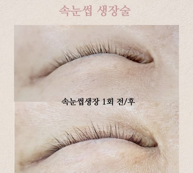 속눈썹생장술 1회권(피부보습)