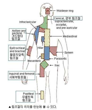 림프집중