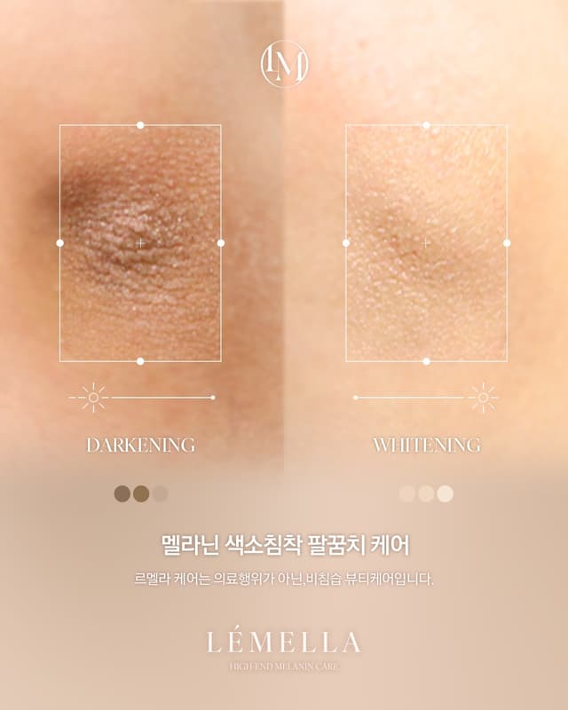 팔꿈치