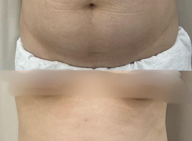 복부관리(50분)