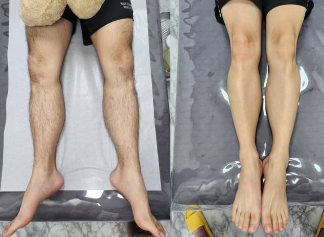 다리 전체 (브왁라인까지 만나게해드림)