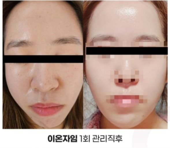 재생.리프팅관리