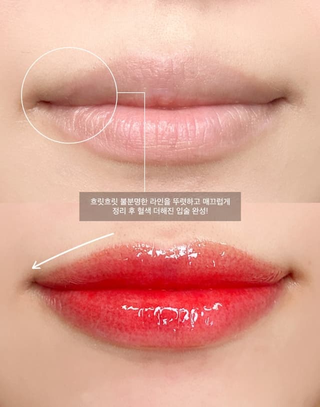 입술