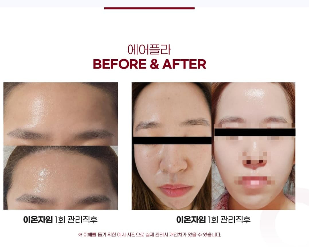 미백.재생 피부관리