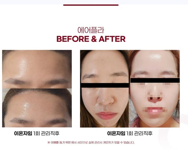 미백.재생 피부관리
