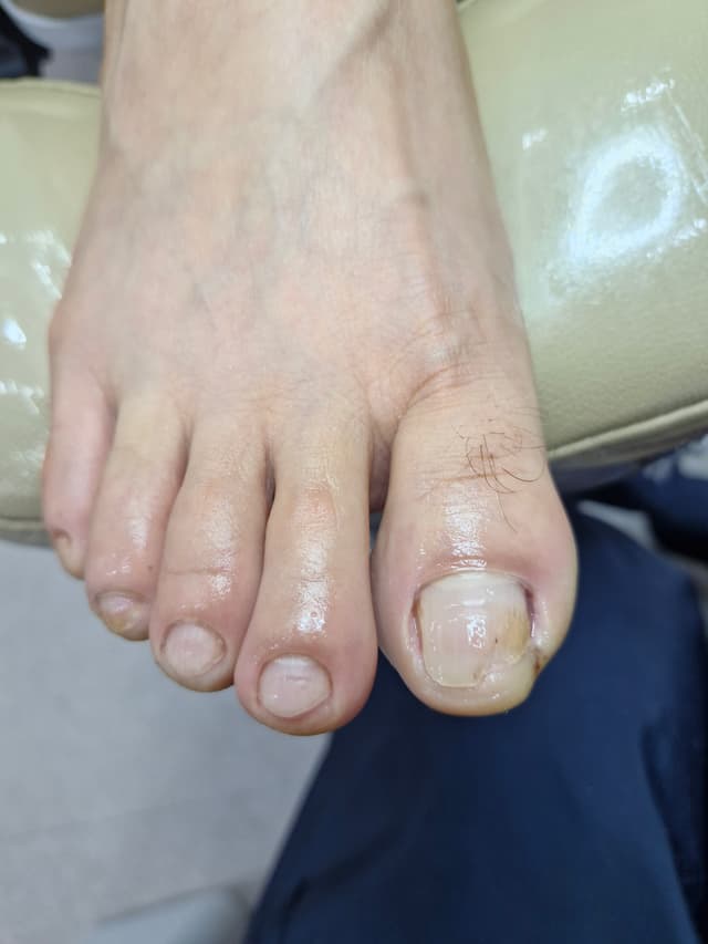 스켈링55000