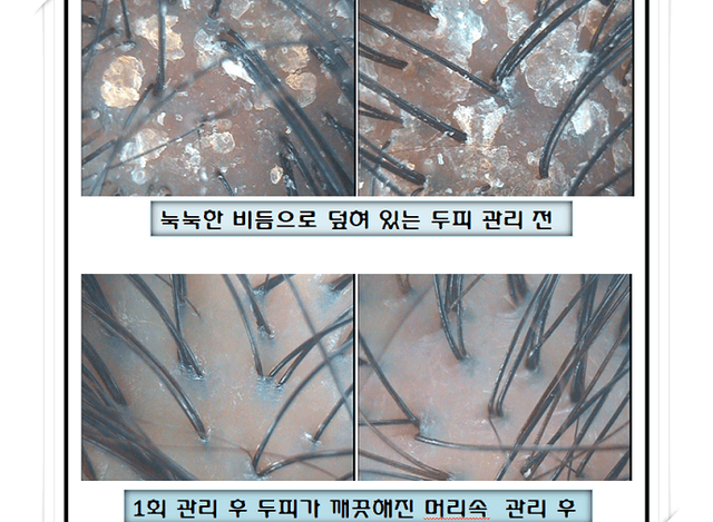 파워 스케일링