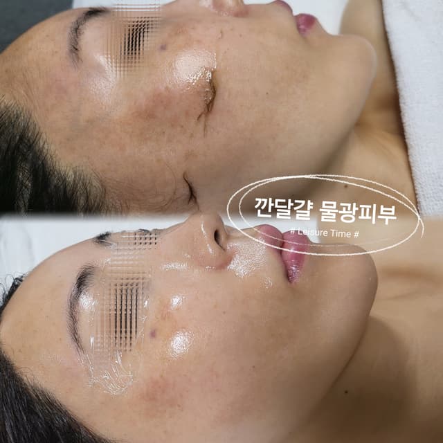 스킨플래닝+물광부스터