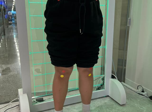 OX다리검사
