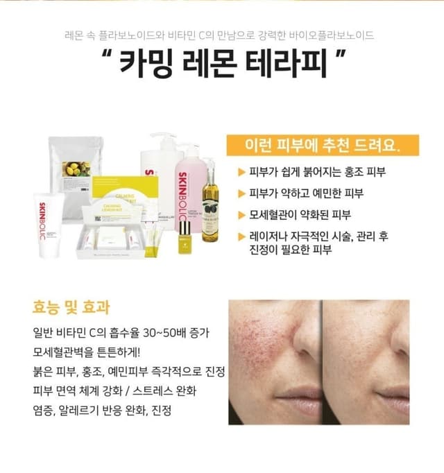 레몬테라피10회