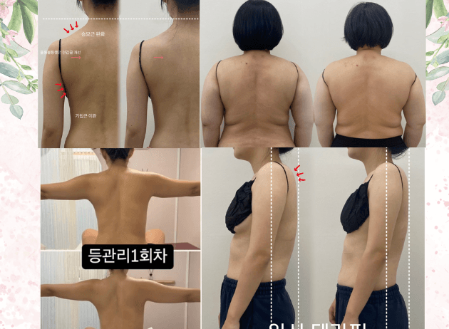 림프 순환부종 해독 관리 60분 (두피부터 후면 테라피 집중-전면부 미포함 )