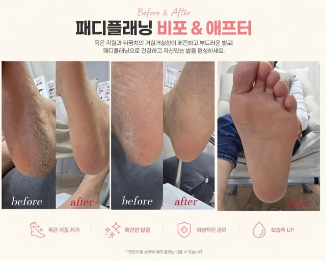 패디플래닝