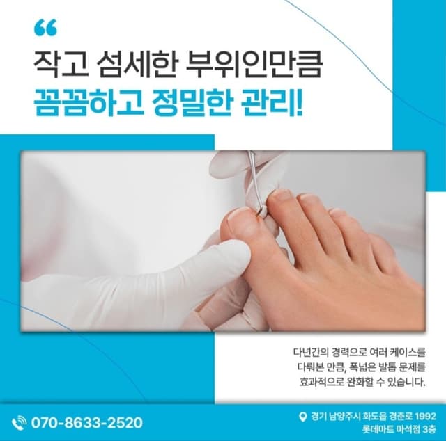 문제성발톱 (내성발톱)