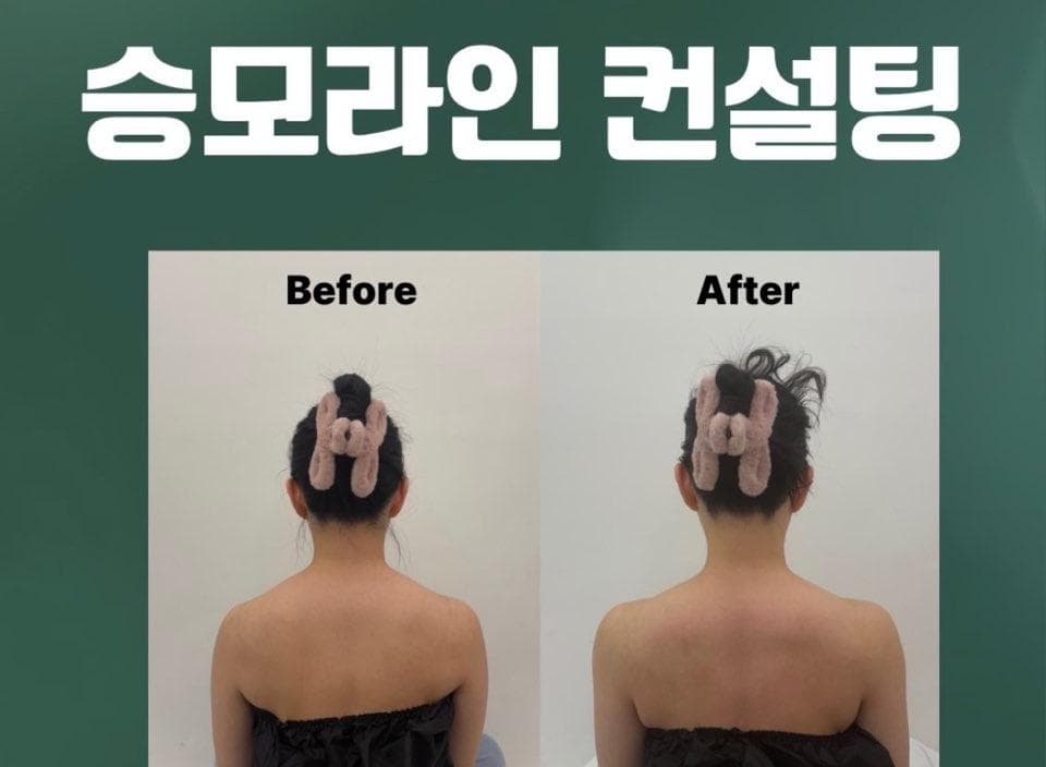 승모 릴렉스 케어