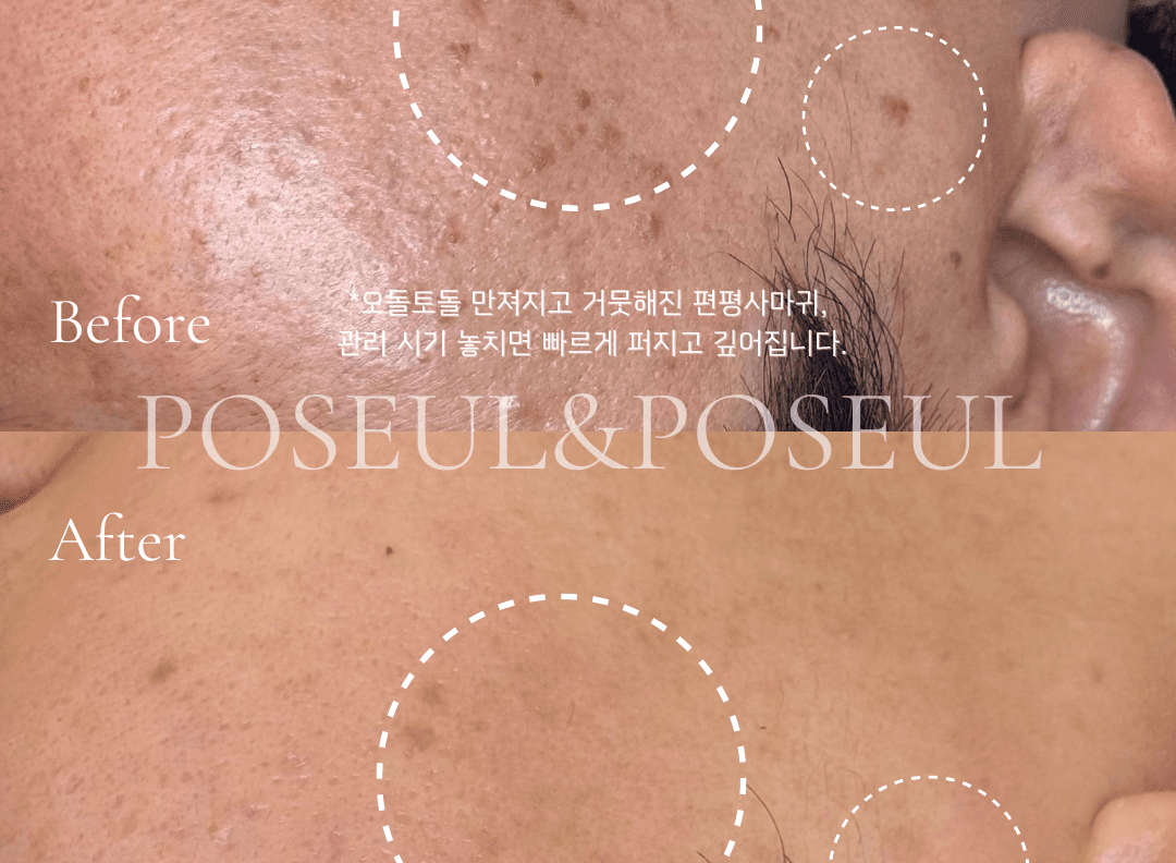 풀페이스 3회
