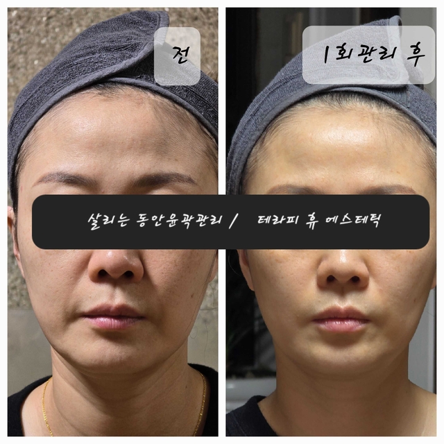 테라피 휴 에스테틱