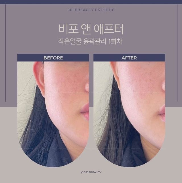 재재뷰티에스테틱