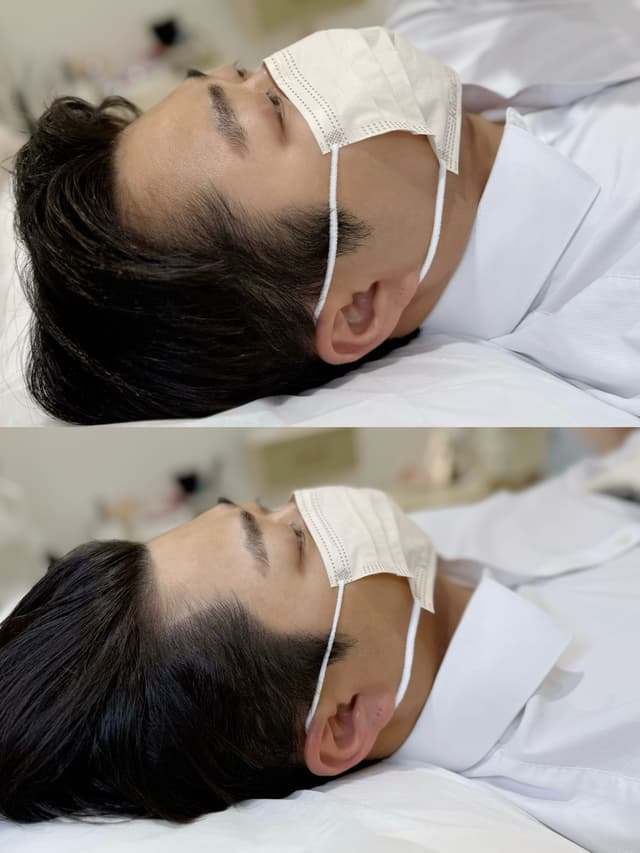 구렛나루라인